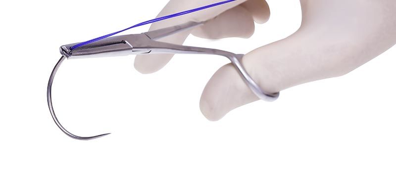 surgical-sutures-glikosorb-nasıl-kullanılır-kullanım-alanları-ameliyat-ipliği-cerrahi-istanbul