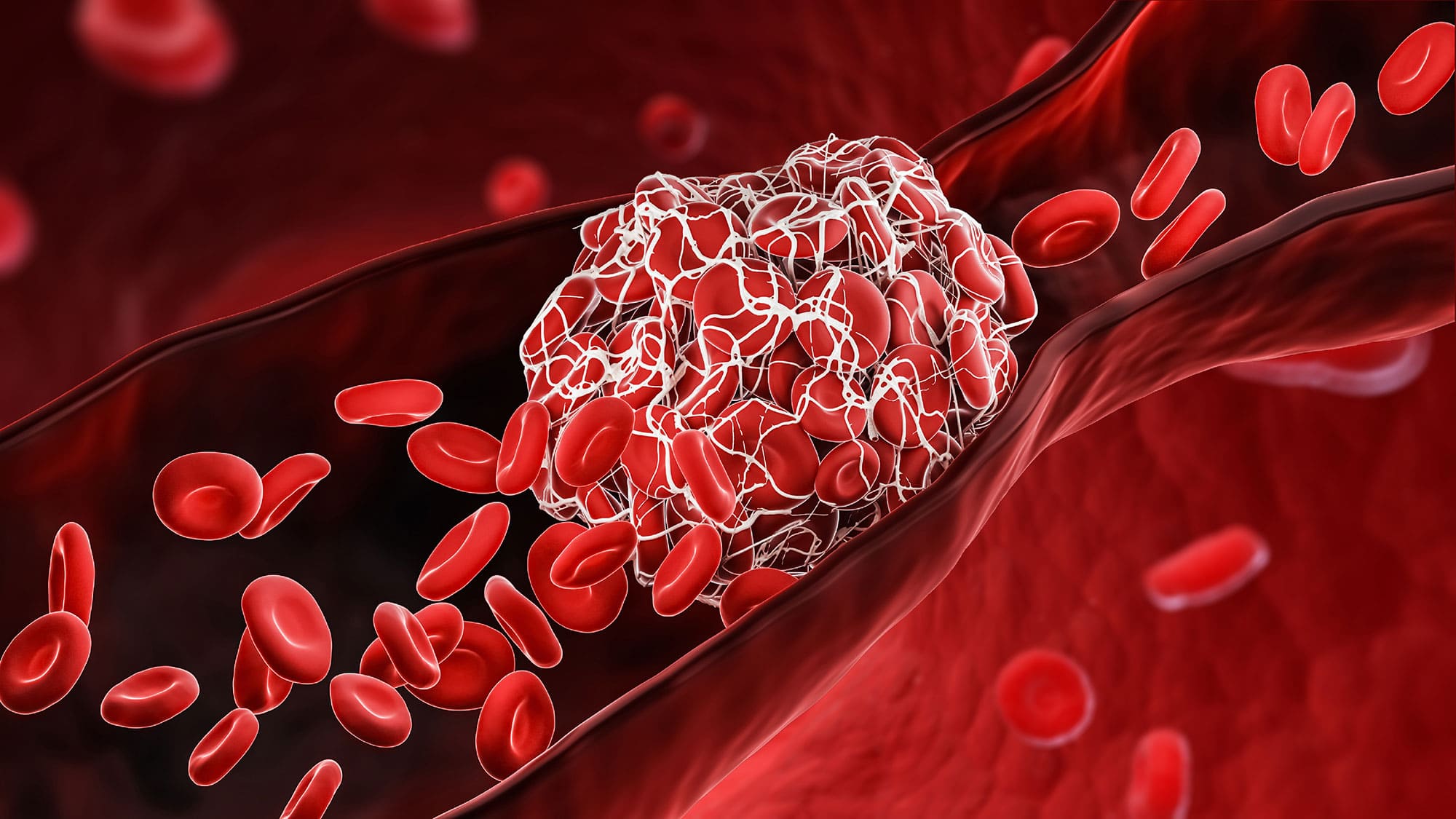 Hemostaz nedir? Trombosit, damarların büzüşmesi ve kan pıhtılaşması, blood-coagulation